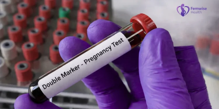 Double Marker Test in Pregnancy